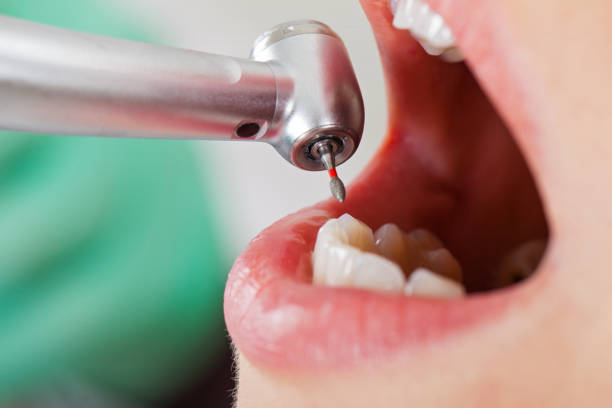 Best Pediatric Emergency Dentist in American Fork, UT